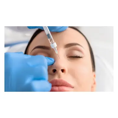 Nose dermal filler