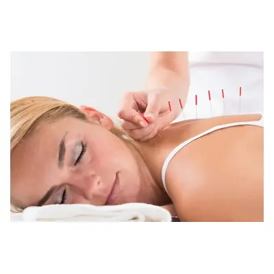 30-Minute Acupuncture Session with 30-Minute Swedish Massage and 10-Minute Consultation