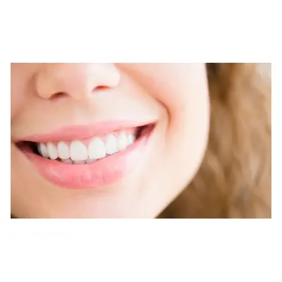 Laser Teeth Whitening