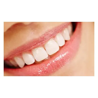 Advanced Teeth Whitening with Take Care Home Trays and Gel (In Office)