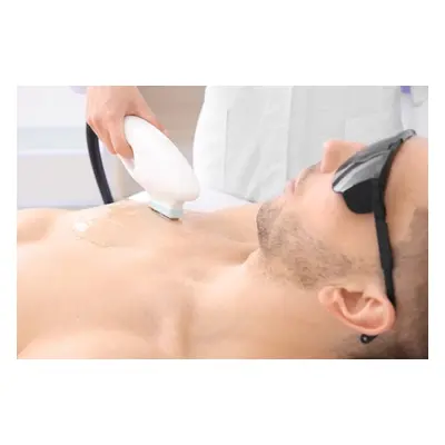 8 Sessions of Medical Grader Laser Hair Removal For Men - Chest