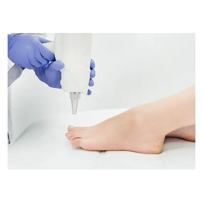 Laser Fungal Nail Removal - Two Feet or Two Hands