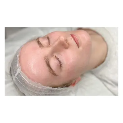 Three Microdermabrasion Facials