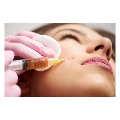 For Face and Neck, PRP Skin Rejuvenation