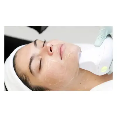 Endymed Skin Tightening Treatment - Three Sessions