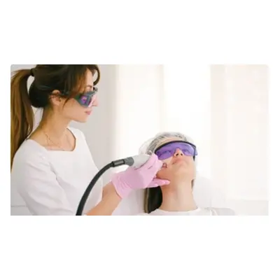 One IPL rejuvenation photo Facial Treatment