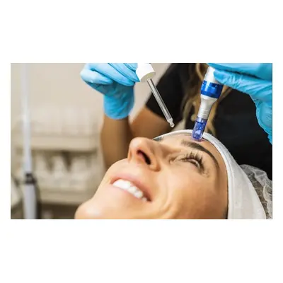 1 Full Face Micro Need needling treatment with Hyaluronic Acid