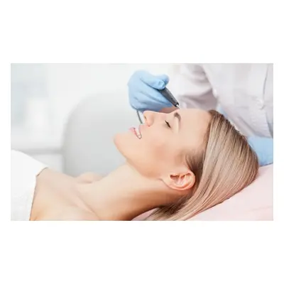 Small area, three sessions of laser hair removal