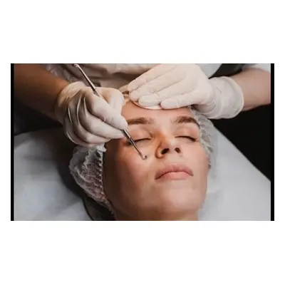 Luxury AZERA Facial with Exfoliation and Extraction