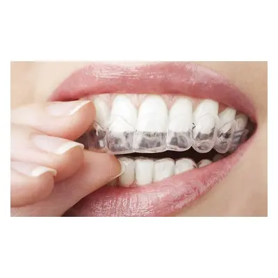 Invisible clear aligner braces for upper and lower teeth