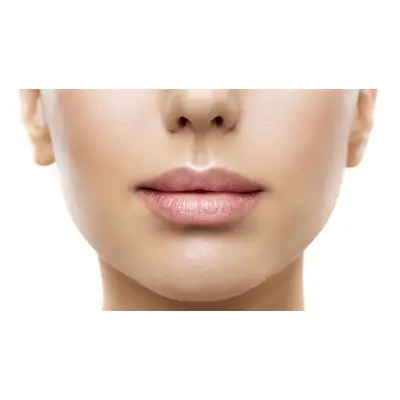 0.5ml Russian Lip Filler with Consultation