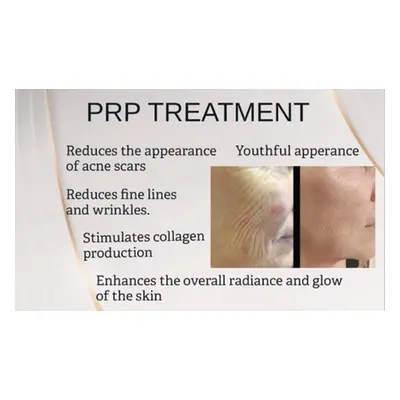 PRP Facial- Revitalize Your Skin