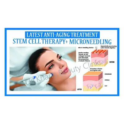 Stem Cell Therapy + Microneedling