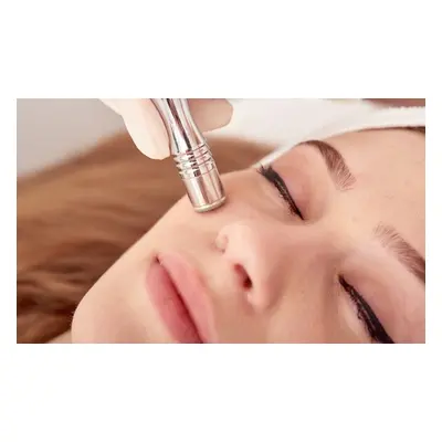 One session diamond dermabrasion skin peeling (18 or older)