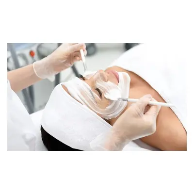 Chemical Peel with TCA