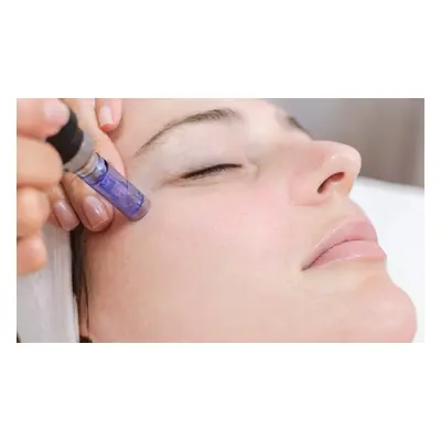 Luxury Microneedling with Deep Cleanse Facial