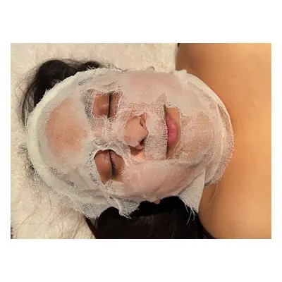 2 sessions Facial peel for all skin types- oily and problematic, blemish prone skin to dull and 