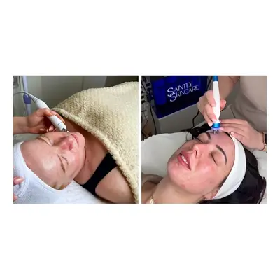 1 x 8 Step Hydra-Dermabrasion Facial - Radio Frequency Ultrasound LED and More