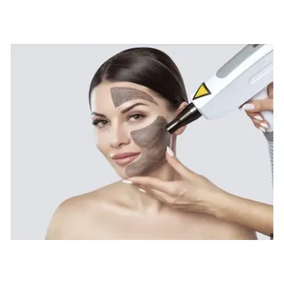 x6 Sessions, Carbon Laser Peel Facial,Hollywood Peel (Including Neck)