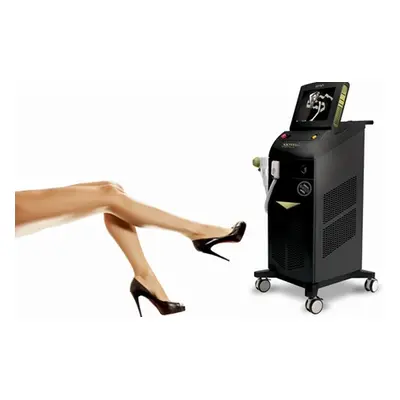 Large area, six sessions of Soprano ICE Platinum laser hair removal