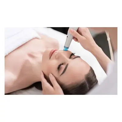 Six microdermabrasion sessions